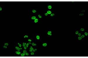 Immunofluorescent analysis of HepG2 cells using ABIN7139618 at dilution of 1:100 and Alexa Fluor 488-congugated AffiniPure Goat Anti-Rabbit IgG(H+L)
