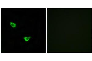 Immunofluorescence analysis of MCF-7 cells, using CHSS2 antibody. (CHPF antibody  (C-Term))