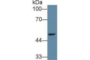 Detection of AGXT2 in Porcine Kidney lysate using Polyclonal Antibody to Alanine Glyoxylate Aminotransferase 2 (AGXT2) (AGXT2 antibody  (AA 259-514))