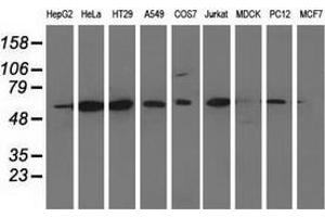 Western blot analysis of extracts (35 µg) from 9 different cell lines by using anti-CD80 monoclonal antibody. (CD80 antibody)