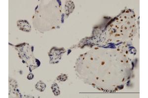 Immunoperoxidase of monoclonal antibody to TEAD4 on formalin-fixed paraffin-embedded human placenta. (TEAD4 antibody  (AA 1-361))