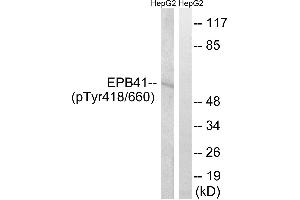 Western blot analysis of extracts from HepG2 cells, treated with PMA (125ng/ml, 30mins), using EPB41 (Phospho-Tyr660/418) antibody. (EPB41 antibody  (pTyr418, pTyr660))