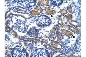 Image no. 1 for anti-Complement Component 4 Binding Protein, beta (C4BPB) (N-Term) antibody (ABIN6735849) (C4BPB antibody  (N-Term))