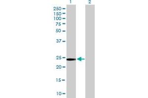 Western Blot analysis of GSTT2 expression in transfected 293T cell line by GSTT2 MaxPab polyclonal antibody. (GSTT2 antibody  (AA 1-244))