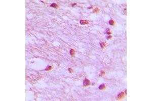 Immunohistochemical analysis of DNA Ligase 4 staining in human brain formalin fixed paraffin embedded tissue section. (LIG4 antibody  (Center))