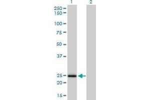 Western Blot analysis of NUDT5 expression in transfected 293T cell line by NUDT5 monoclonal antibody (M04), clone 2A3.