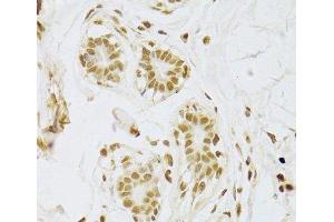 Immunohistochemistry (Paraffin-embedded Sections) (IHC (p)) image for anti-Small Nuclear Ribonucleoprotein Polypeptide A (SNRPA) antibody (ABIN7262230)
