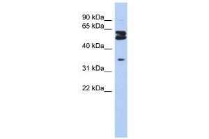 OGFOD1 antibody used at 1 ug/ml to detect target protein. (OGFOD1 antibody  (Middle Region))