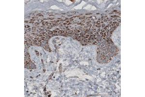 Immunohistochemical staining (Formalin-fixed paraffin-embedded sections) of human skin with CS monoclonal antibody, clone CL2545  shows granular cytoplasmic immunoreactivity in epithelial cells. (CS antibody)