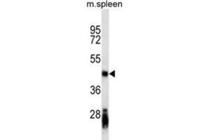 Western Blotting (WB) image for anti-B-cell antigen receptor complex-associated protein alpha chain (CD79A) antibody (ABIN2900561)