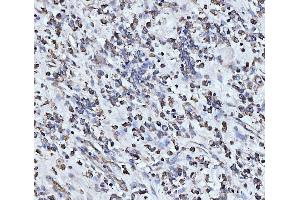 IHC analysis of PDCD4 using anti-PDCD4 antibody (ABIN5518943).