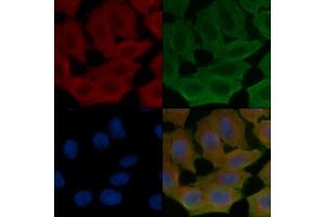 ABIN6260904 and ABIN6272275 staining Hela cells(24h of starvation treatment) by IF/ICC. (CMTM4 antibody  (N-Term))