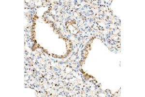 Immunohistochemistry (IHC) image for anti-WW Domain Containing Transcription Regulator 1 (WWTR1) (AA 1-230) antibody (ABIN6150278)