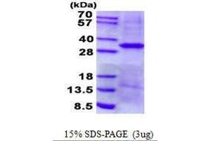 Figure annotation denotes ug of protein loaded and % gel used. (EpCAM Protein)