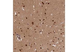 Immunohistochemical staining (Formalin-fixed paraffin-embedded sections) of human cerebral cortex with ADIG polyclonal antibody  shows strong nuclear positivity in glial cells. (ADIG antibody)