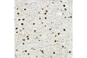 Immunohistochemistry of paraffin-embedded rat brain using TE Rabbit pAb (ABIN6129488, ABIN6148982, ABIN6148984 and ABIN6217332) at dilution of 1:100 (40x lens). (TEAD1 antibody  (AA 135-215))