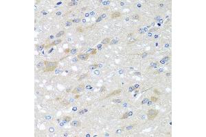 Immunohistochemistry of paraffin-embedded rat brain using NDUFS3 antibody. (NDUFS3 antibody  (AA 37-264))