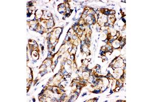 Anti-Sonic Hedgehog antibody,  IHC(P) IHC(P): Human Mammary Tissue (Sonic Hedgehog antibody  (N-Term))