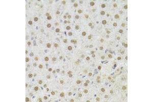 Immunohistochemistry of paraffin-embedded rat liver using HDGF Antibody. (HDGF antibody  (AA 1-240))