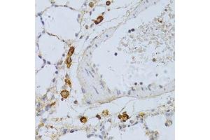 Immunohistochemistry of paraffin-embedded rat lung using PHGDH antibody.