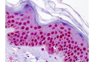Human Skin: Formalin-Fixed, Paraffin-Embedded (FFPE) (Aryl Hydrocarbon Receptor antibody  (N-Term))