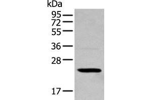 Western blot analysis of 293T cell using TCEAL4 Polyclonal Antibody at dilution of 1:250 (TCEAL4 antibody)