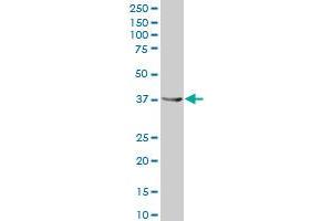 AKR1C1 polyclonal antibody (A01), Lot # 070510JCS1 Western Blot analysis of AKR1C1 expression in HeLa . (AKR1C1 antibody  (AA 1-110))