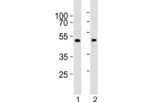 Western blot analysis of lysate from 1) human brain and 2) mouse brain tissue lysate using PRMT8 antibody at 1:1000. (PRMT8 antibody  (AA 344-373))