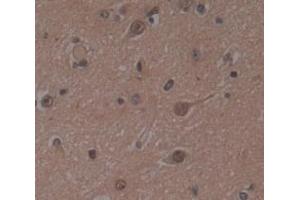 IHC-P analysis of Human Tissue, with DAB staining. (MAPK14 antibody  (AA 19-279))
