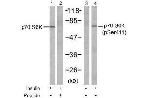 Image no. 2 for anti-Ribosomal Protein S6 Kinase, 70kDa, Polypeptide 1 (RPS6KB1) (pSer411) antibody (ABIN197034)