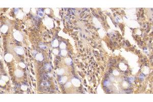 Detection of WNT3A in Human Small intestine Tissue using Monoclonal Antibody to Wingless Type MMTV Integration Site Family, Member 3A (WNT3A) (WNT3A antibody  (AA 1-290))