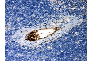 Anti- SERPINA1 Picoband antibody, IHC(P) IHC(P): Mouse Spleen Tissue (SERPINA1 antibody  (AA 211-411))