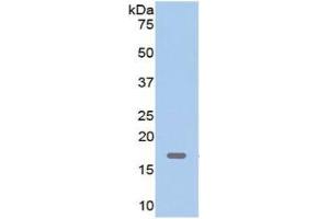 WB of Protein Standard: different control antibodies  against Highly purified E. (Myoglobin ELISA Kit)