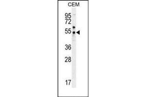 Western blot analysis of PSMAL Antibody (C-term) in CEM cell line lysates (35ug/lane). (FOLH1B antibody  (C-Term))