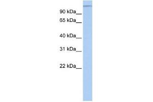 MTUS1 antibody used at 1 ug/ml to detect target protein. (MTUS1 antibody  (Middle Region))