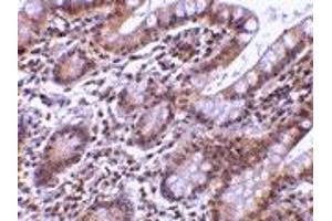 Immunohistochemistry (IHC) image for anti-Baculoviral IAP Repeat-Containing 7 (BIRC7) antibody (ABIN1031705)