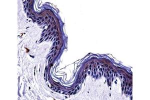 Immunohistochemistry (IHC) image for anti-Tyrosinase (TYR) (AA 486-513) antibody (ABIN3029406)