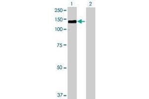 Lane 1: HDAC4 transfected lysate ( 106.