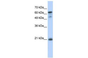 GCET2 antibody used at 1 ug/ml to detect target protein. (GCET2 antibody  (Middle Region))