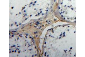 Used in DAB staining on fromalin fixed paraffin-embedded testis tissue (Insulin Like Protein 3 (AA 2-129) antibody)