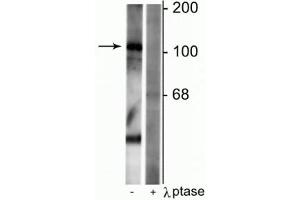 Western blot of rat synaptic membrane lysate showing specific immunolabeling of the ~102 kDa GABAB R1 protein phosphorylated at Ser923 in the first lane (-). (GABBR1 antibody  (pSer923))