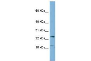 Image no. 1 for anti-Protein Phosphatase 1, Regulatory (Inhibitor) Subunit 11 (PPP1R11) (N-Term) antibody (ABIN6741758) (PPP1R11 antibody  (N-Term))