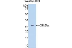 Western blot analysis of the recombinant protein. (CYP1A2 antibody  (AA 2-231))