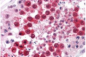 Immunohistochemistry (Formalin-fixed Paraffin-embedded Sections) (IHC (fp)) image for anti-Protein Phosphatase 1, Regulatory (Inhibitor) Subunit 2 (PPP1R2) (AA 1-101) antibody (ABIN574321)