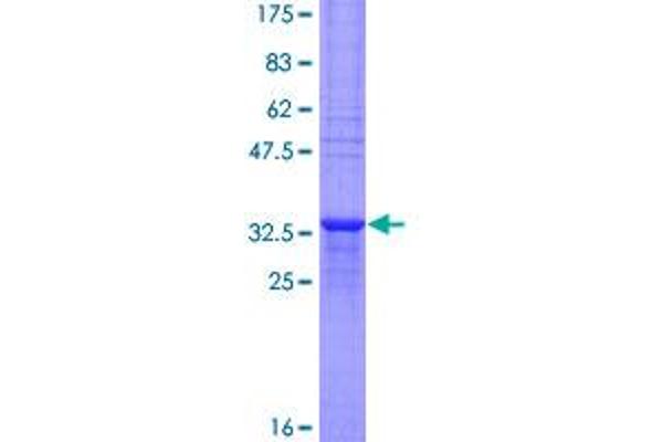 MTCP1 Protein (AA 1-68) (GST tag)