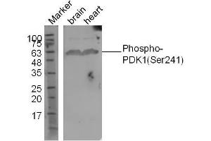 PDPK1 抗体  (pSer241)