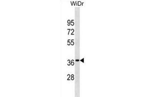 OR6K3 Antibody (N-term) (ABIN1881608 and ABIN2838717) western blot analysis in WiDr cell line lysates (35 μg/lane).