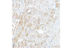Immunohistochemistry of paraffin-embedded mouse heart using PDK4 Rabbit pAb (ABIN6132477, ABIN6145396, ABIN6145397 and ABIN6217290) at dilution of 1:100 (40x lens). (PDK4 antibody  (AA 102-411))