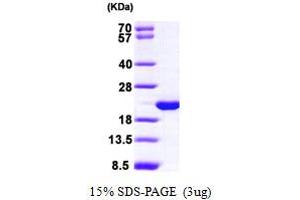 SDS-PAGE (SDS) image for Hippocalcin-Like 1 (HPCAL1) (AA 1-193) protein (His tag) (ABIN667823) (HPCAL1 Protein (AA 1-193) (His tag))