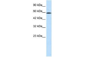 WB Suggested Anti-ASH2L Antibody Titration:  0. (ASH2L antibody  (N-Term))